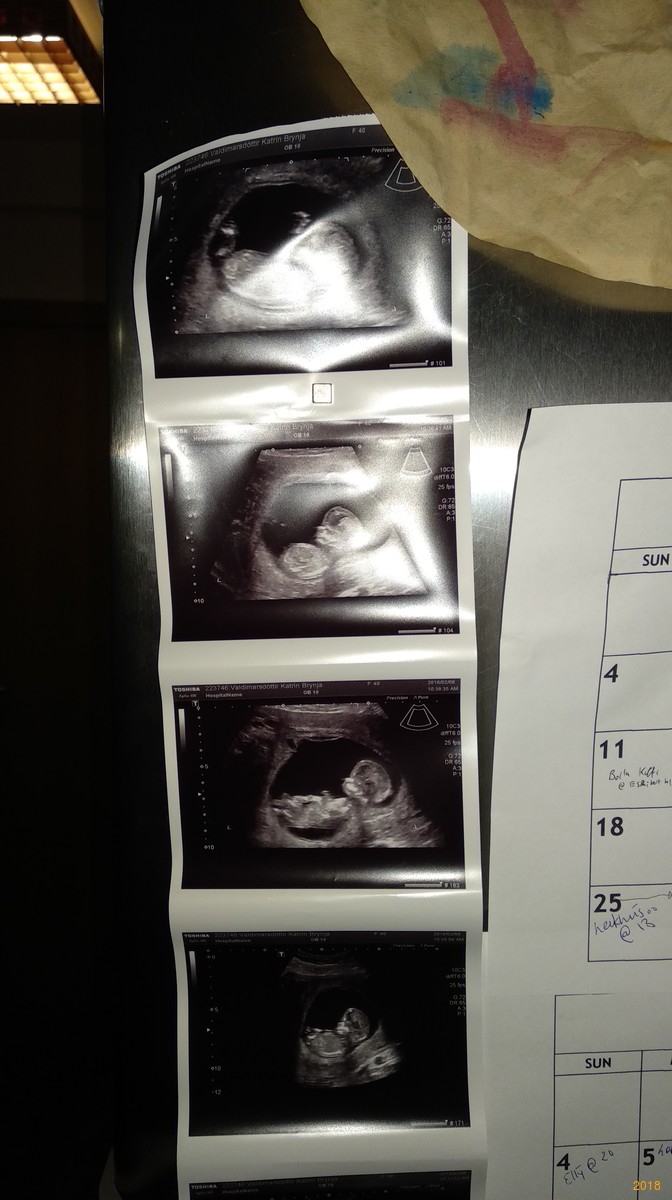 Having a little baby!